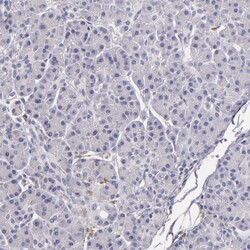 Invitrogen TLR8 Polyclonal Antibody 100 &mu;L; Unconjugated:Antibodies,