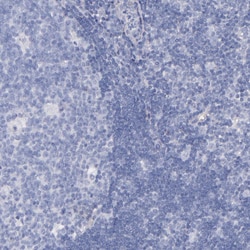 Invitrogen Kininogen 1 Polyclonal Antibody 100 &mu;L; Unconjugated:Antibodies,