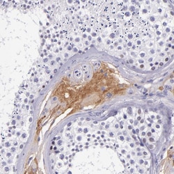 Invitrogen Kininogen 1 Polyclonal Antibody 100 &mu;L; Unconjugated:Antibodies,