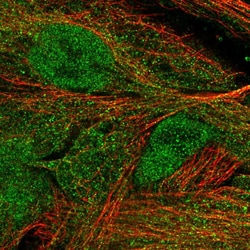 Invitrogen MASP1 Polyclonal Antibody 100 &mu;L; Unconjugated:Antibodies,