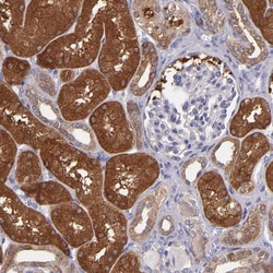 Invitrogen PAPPA Polyclonal Antibody 100 &mu;L; Unconjugated:Antibodies,