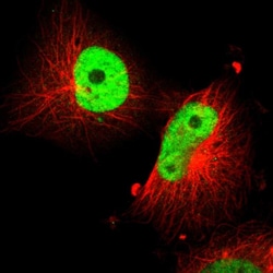 Invitrogen SOX9 Polyclonal Antibody 100 &mu;L; Unconjugated:Antibodies,