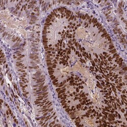 Invitrogen SOX9 Polyclonal Antibody 100 &mu;L; Unconjugated:Antibodies,
