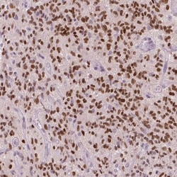 Invitrogen SOX9 Polyclonal Antibody 100 &mu;L; Unconjugated:Antibodies,
