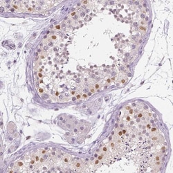 Invitrogen SOX9 Polyclonal Antibody 100 &mu;L; Unconjugated:Antibodies,