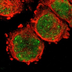 Invitrogen HIF-1 beta Polyclonal Antibody 100 &mu;L; Unconjugated:Antibodies,