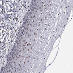 Invitrogen HIF-1 beta Polyclonal Antibody 100 &mu;L; Unconjugated:Antibodies,