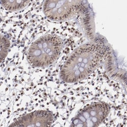 Invitrogen HIF-1 beta Polyclonal Antibody 100 &mu;L; Unconjugated:Antibodies,