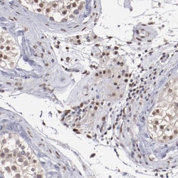 Invitrogen HIF-1 beta Polyclonal Antibody 100 &mu;L; Unconjugated:Antibodies,