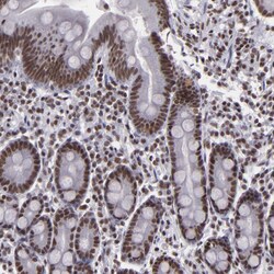 Invitrogen BRD8 Polyclonal Antibody 100 &mu;L; Unconjugated:Antibodies,