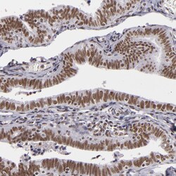 Invitrogen BRD8 Polyclonal Antibody 100 &mu;L; Unconjugated:Antibodies,