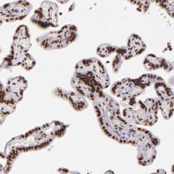 Invitrogen BRD8 Polyclonal Antibody 100 &mu;L; Unconjugated:Antibodies,