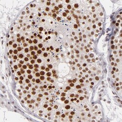 Invitrogen BRD8 Polyclonal Antibody 100 &mu;L; Unconjugated:Antibodies,