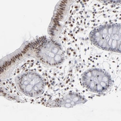 Invitrogen IRF9 Polyclonal Antibody 100 &mu;L; Unconjugated:Antibodies,