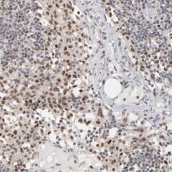 Invitrogen IRF9 Polyclonal Antibody 100 &mu;L; Unconjugated:Antibodies,