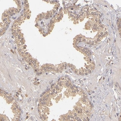 Invitrogen PKC delta Polyclonal Antibody 100 &mu;L; Unconjugated:Antibodies,