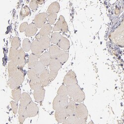 Invitrogen PKC delta Polyclonal Antibody 100 &mu;L; Unconjugated:Antibodies,