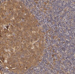 Invitrogen PKC delta Polyclonal Antibody 100 &mu;L; Unconjugated:Antibodies,