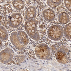 Invitrogen PKC delta Polyclonal Antibody 100 &mu;L; Unconjugated:Antibodies,