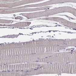 Invitrogen VAV1 Polyclonal Antibody 100 &mu;L; Unconjugated:Antibodies,