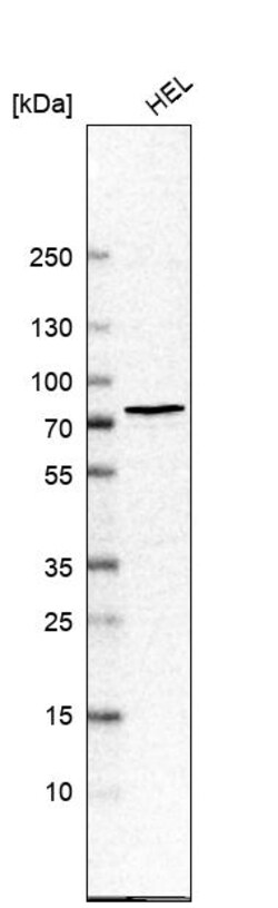 Invitrogen CHK2 Polyclonal Antibody 100 &mu;L | Buy Online | Invitrogen&trade; | Fisher Scientific