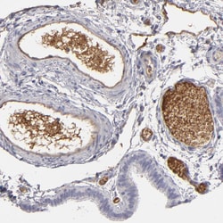 Invitrogen LRG1 Polyclonal Antibody 100 &mu;L; Unconjugated:Antibodies,