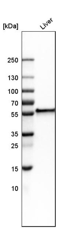 Invitrogen FIBB Polyclonal Antibody 100 &mu;L | Buy Online | Invitrogen&trade; | Fisher Scientific
