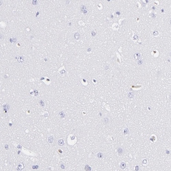 Invitrogen FIBB Polyclonal Antibody 100 &mu;L; Unconjugated:Antibodies,