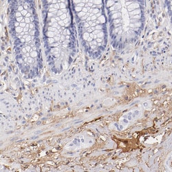 Invitrogen FIBB Polyclonal Antibody 100 &mu;L; Unconjugated:Antibodies,