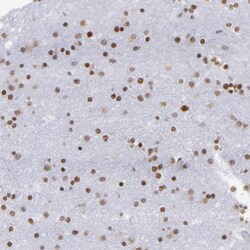 Invitrogen TRF2 Polyclonal Antibody 100 &mu;L; Unconjugated:Antibodies,