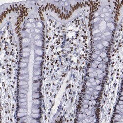 Invitrogen TRF2 Polyclonal Antibody 100 &mu;L; Unconjugated:Antibodies,