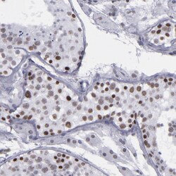 Invitrogen TRF2 Polyclonal Antibody 100 &mu;L; Unconjugated:Antibodies,