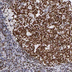 Invitrogen TRF2 Polyclonal Antibody 100 &mu;L; Unconjugated:Antibodies,