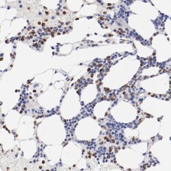 Invitrogen FGR Polyclonal Antibody 100 &mu;L; Unconjugated:Antibodies,