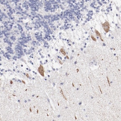Invitrogen FGR Polyclonal Antibody 100 &mu;L; Unconjugated:Antibodies,