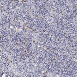Invitrogen FGR Polyclonal Antibody 100 &mu;L; Unconjugated:Antibodies,