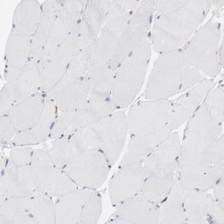 Invitrogen FGR Polyclonal Antibody 100 &mu;L; Unconjugated:Antibodies,