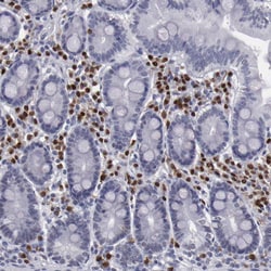 Invitrogen IRF4 Polyclonal Antibody 100 &mu;L | Buy Online | Invitrogen&trade; | Fisher Scientific