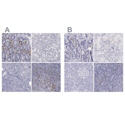 Invitrogen IRF4 Polyclonal Antibody 100 &mu;L | Buy Online | Invitrogen&trade; | Fisher Scientific