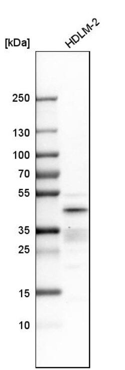 Invitrogen IRF4 Polyclonal Antibody 100 &mu;L | Buy Online | Invitrogen&trade; | Fisher Scientific