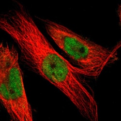 Invitrogen LEF1 Polyclonal Antibody 100 &mu;L; Unconjugated:Antibodies,