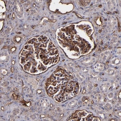 Invitrogen ICAM-1 Polyclonal Antibody 100 &mu;L; Unconjugated:Antibodies,