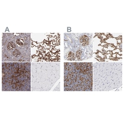 Invitrogen&trade;&nbsp;ICAM-1 Polyclonal Antibody