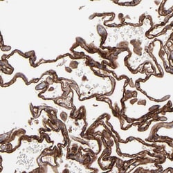 Invitrogen ICAM-1 Polyclonal Antibody 100 &mu;L; Unconjugated:Antibodies,