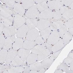 Invitrogen ICAM-1 Polyclonal Antibody 100 &mu;L; Unconjugated:Antibodies,