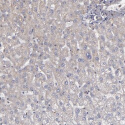 Invitrogen CD55 Polyclonal Antibody 100 &mu;L | Buy Online | Invitrogen&trade; | Fisher Scientific