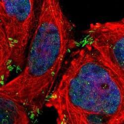 Invitrogen P-Glycoprotein Polyclonal Antibody 100 &mu;L | Buy Online | Invitrogen&trade; | Fisher Scientific