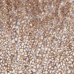 Invitrogen P-Glycoprotein Polyclonal Antibody 100 &mu;L | Buy Online | Invitrogen&trade; | Fisher Scientific