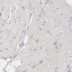Invitrogen P-Glycoprotein Polyclonal Antibody 100 &mu;L | Buy Online | Invitrogen&trade; | Fisher Scientific