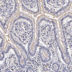 Invitrogen P-Glycoprotein Polyclonal Antibody 100 &mu;L | Buy Online | Invitrogen&trade; | Fisher Scientific